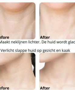 Everything You Want EYW Gezichtsnek Massageapparaat – Fatburner – Vetverbrander - Dubbele Kin - Dubbele Kin Afslanker - Onderkin Afslanker - Met Warmtefunctie – Elektrische - Wit -KLASVSA Verkoop 550x571 3